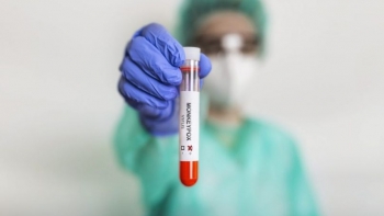 Imagem de Moçambique: Casos suspeitos de Mpox na Beira testam negativo