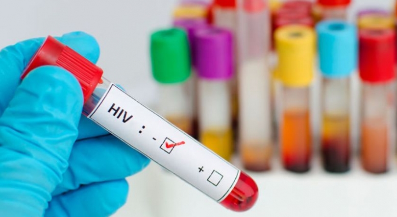 Imagem de Moçambique: 2,6 milhões com VIH/SIDA, uma das principais causas de morte