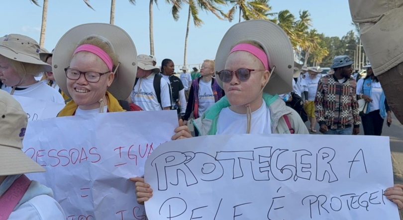 Imagem de Pessoas com albinismo marcham em Maputo e exigem respostas do Governo.
